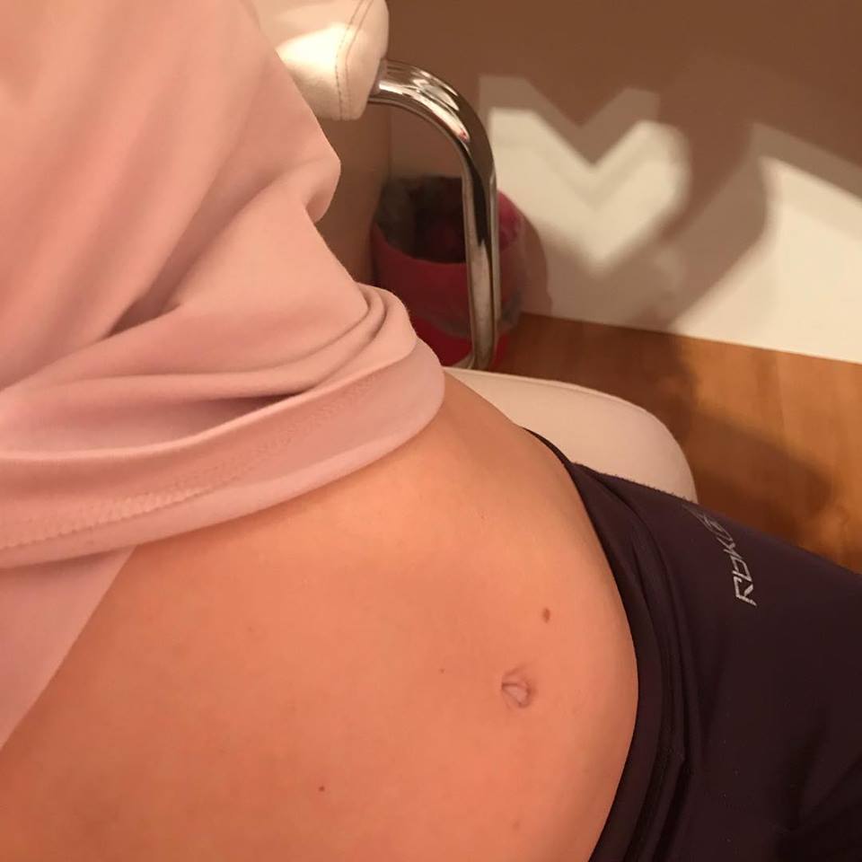 Foto da barriga de uma mulher que está sentada e com o umbigo à mostra. Ao fundo, há a sombra de um coração na parede.